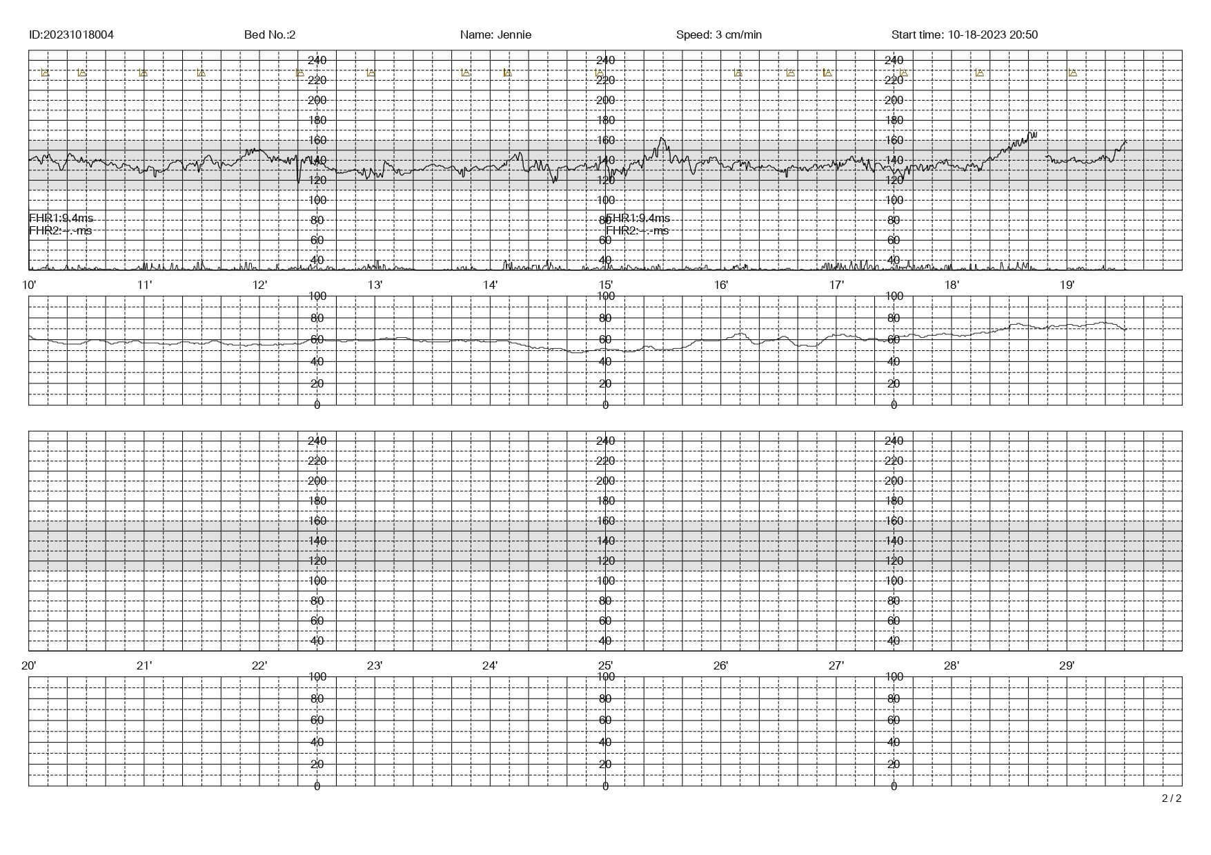 Touchscreen Fetal Monitor for Single/Twin Fetuses. Support FHR, TOCO